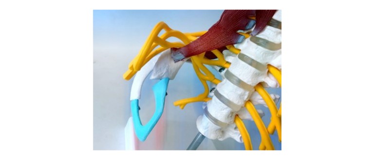 Предна част на гръбначния стълб структура и функция възможни наранявания и тяхното лечение Какви са структурата и функцията на гръбначния стълб