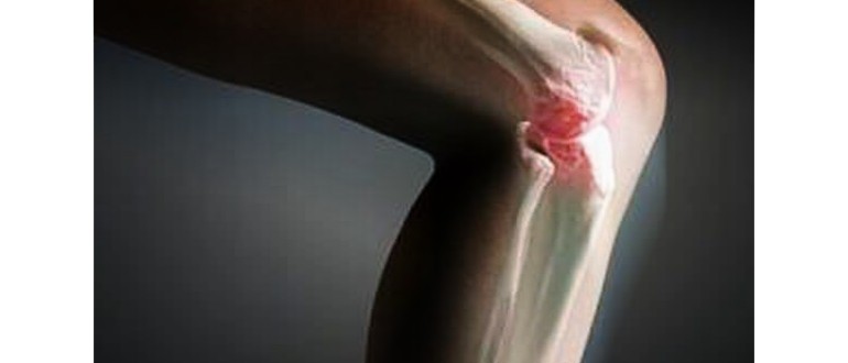 Болка в коляното при изправяне след продължително седене - причини и начини за облекчение