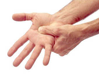 Флебит на ръката: причини, симптоми, лечение