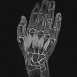 ЯМР на ръката и ръката: томография на китката