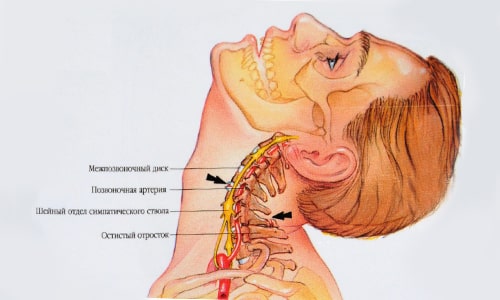 Структурата, анатомията и функциите на шийката на гръбначния стълб при хората
