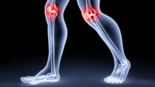 Структурата и заболяванията на колянния менискус