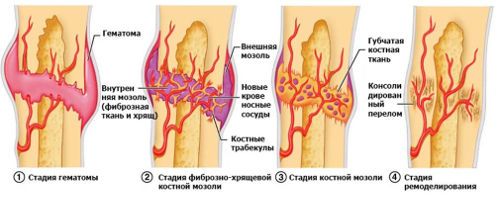 Регенерация на костната тъкан