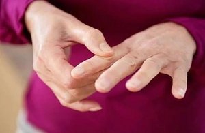 Как да се лекува артрит на пръстите в дома: преглед на специални техники