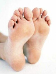 Артроза на крака: симптоми на заболяването и превенцията му