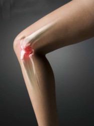 Причини за остеоартрит на коляното (гонартроза)