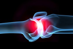 Причините за артроза: защо има деформиране на остеоартрита