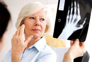 Какви диагностични методи могат точно да определят, че имате остеоартрит? *