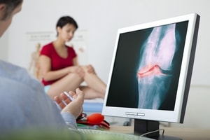Какви диагностични методи могат точно да определят, че имате остеоартрит? *