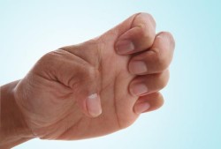10 упражнения за пръсти с артроза (снимка)