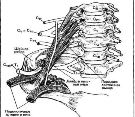 Описание, причини и симптоми на синдрома на горната гръдна апертура