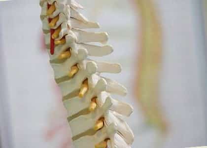Причини, симптоми на притискане на нерва в гръбначния стълб и лечение в дома