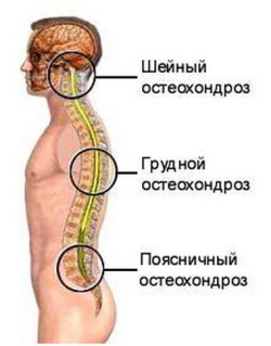 Болест на симптомите на лумбалната част на гръбначния стълб