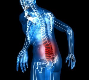 Народни средства за лечение на остеохондроза на лумбалния гръбначен стълб
