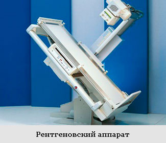 Радиография на лумбосакралния гръбначен стълб