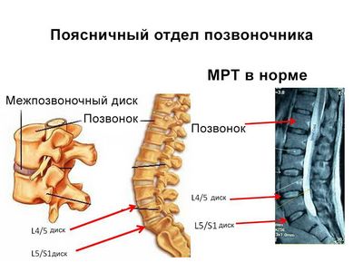 Томография на лумбалния гръбначен стълб