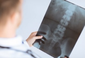 Рентгенов анализ на препарата на лумбалния гръбначен стълб