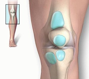 Последици от артрита на коляното