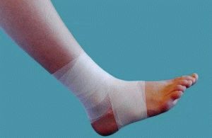 Превръзки за лечение на трофични язви по краката