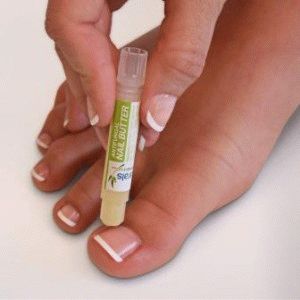Как да се справим с гъбичките на ноктите на краката