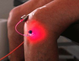 Лазерна терапия за артроза на колянната става