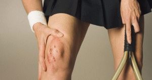 Медицинска жлъчка с артроза на колянната става