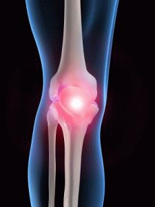 Лечение на артроза на колянната става с желатин