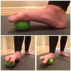 Лечение на плоски крака от трета степен при възрастни