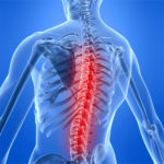 Как и какво да лекува херния на лумбосакралния гръбначен стълб?
