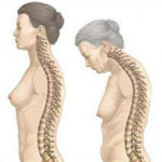 Болка в долната част на гърба на жена - какъв може да е проблемът?