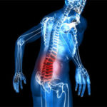 Защо болката в гърба дава в краката - най-честите причини и лечение
