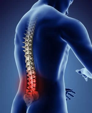 Болки в гърба или вертеброгенна лумбосциалност - причини, симптоми и лечение
