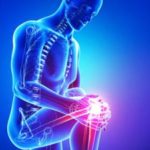 Увреждане на менискуса на колянната става: симптоми, лечение и операция