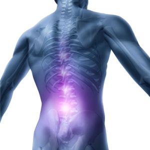 Дорсалгия - синдром на болката в гръбначния стълб