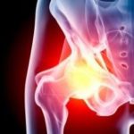 Ефективно лечение на хроничен и реактивен синовит на колянната става