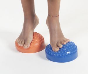 Характеристики на деформациите на крака на валгус при деца: симптоми, лечение и профилактика