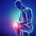Възможно ли е лечение на ганартроза на колянната става от 3-та степен и защо се получава увреждане?