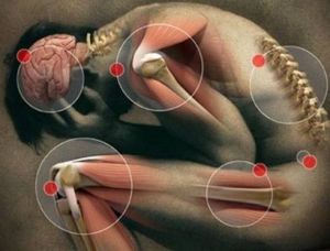 Синдром на Myofascial pain с различна локализация