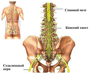 Болезнен синдром на конска опашка в задната част на човека