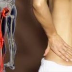 Основните симптоми на синдрома на гръбначните артерии и тяхното лечение
