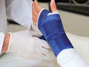 Лечение и рехабилитация след счупване на скуоидната кост на ръката