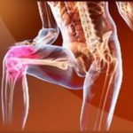 Лечение на артрит на коляното съвместно народни средства: мазила, компреси, хранене