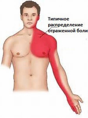 Гръдна и вертебрална торакалгия - гръдна болка