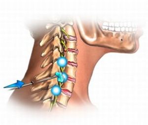 Какво може да причини болка в гръбначния стълб?