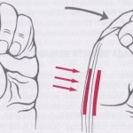 Болест на De Carven: симптоми, причини, лечение на теносиновит на ръката