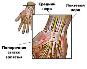 Първа помощ и лечение след опъване на връзките на ръката