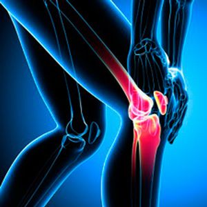 Първа помощ при разкъсване на сухожилията на колянната става