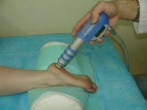 Възпаление на сухожилието на тендонита на краката: сериозна материя