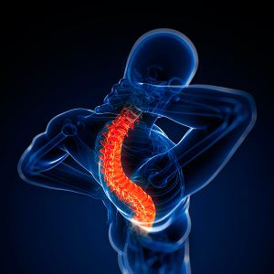 Полисегментарна остеохондроза на гръбначния стълб: подробности за основното