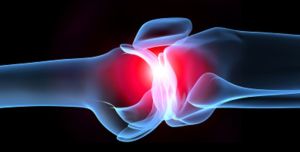 Септичен артрит: как една инфекция разрушава нашите стави
